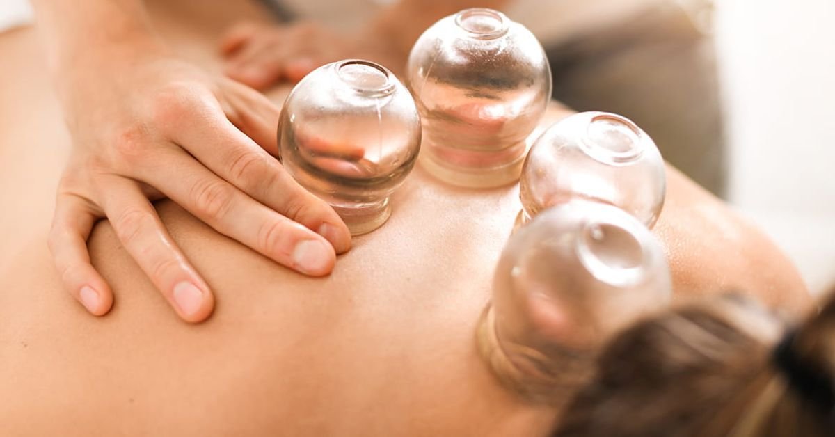 Cupping Therapy Benefits