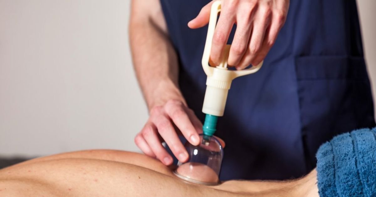 Types of Cupping Therapies