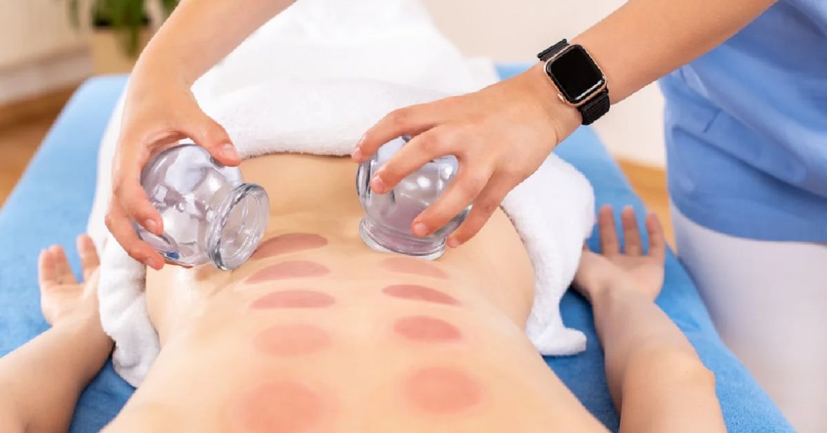 Best Cupping Therapy Center in Rishikesh