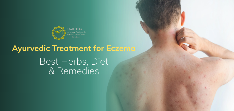 Ayurvedic Treatment for Eczema