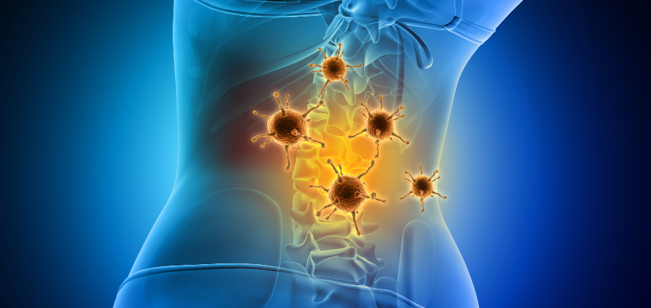 Ayurvedic Medicine for H pylori