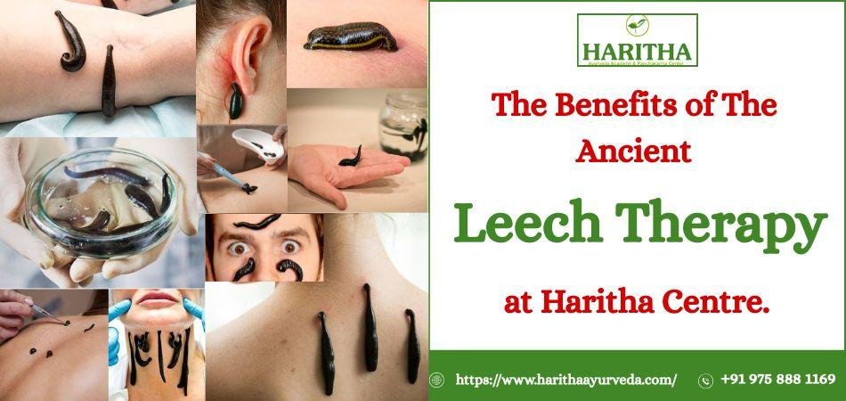 The Benefits of The Ancient Leech Therapy at Haritha Centre.
